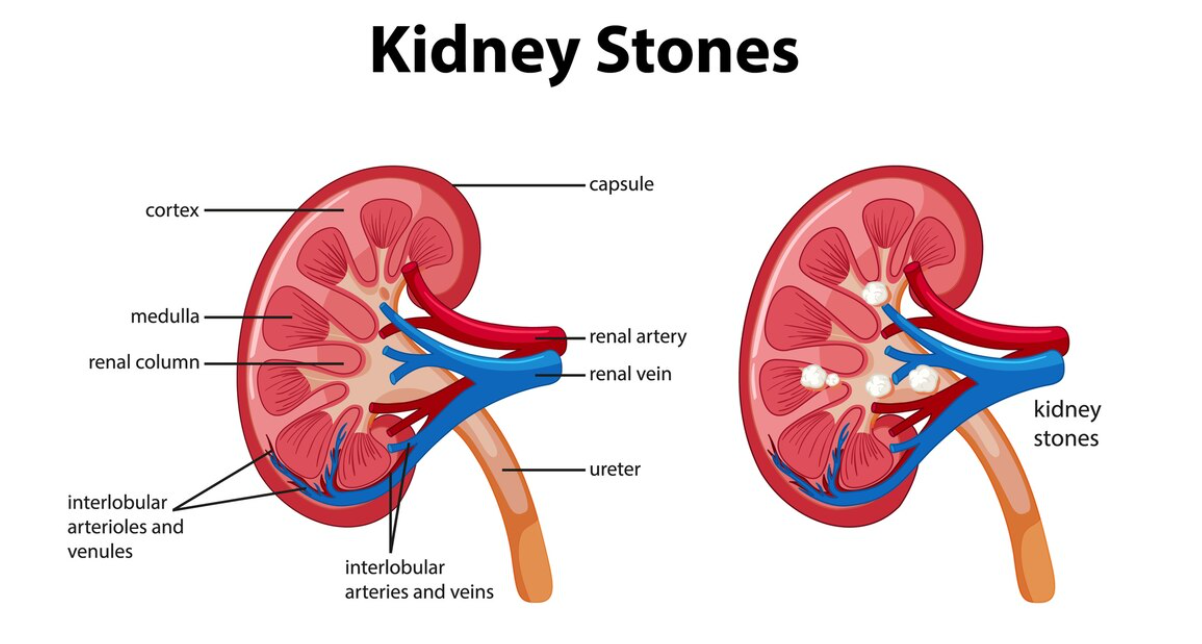 renal